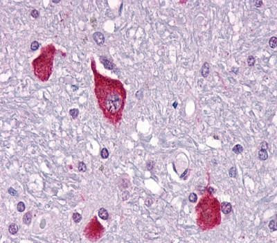 PTH2R Antibody in Immunohistochemistry (Paraffin) (IHC (P))