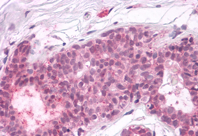 PTPRA Antibody in Immunohistochemistry (Paraffin) (IHC (P))