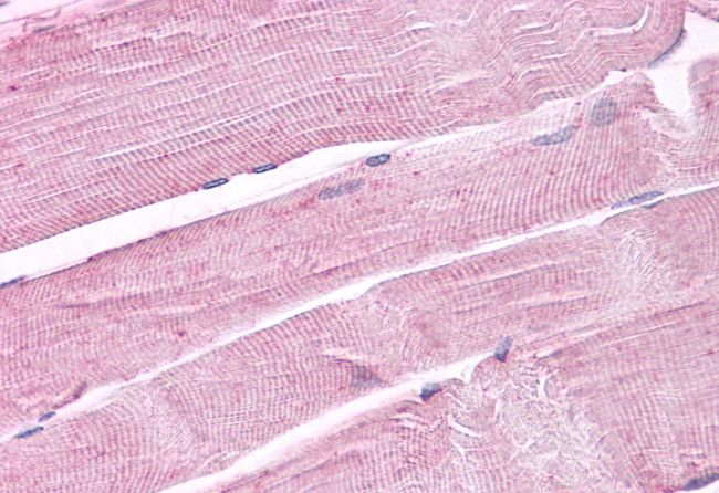 PTPRA Antibody in Immunohistochemistry (Paraffin) (IHC (P))