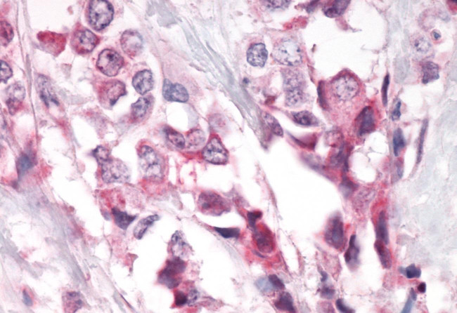 PTPRA Antibody in Immunohistochemistry (Paraffin) (IHC (P))