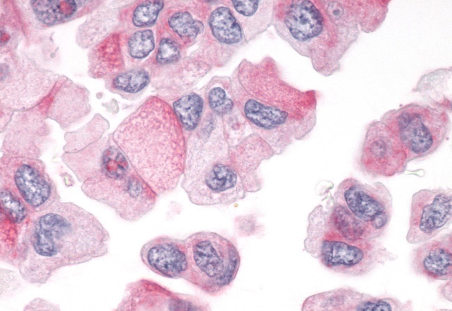 PTPRA Antibody in Immunohistochemistry (Paraffin) (IHC (P))