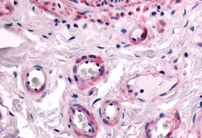 PTPRE Antibody in Immunohistochemistry (Paraffin) (IHC (P))