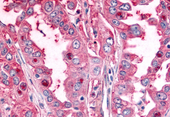 PTPRE Antibody in Immunohistochemistry (Paraffin) (IHC (P))