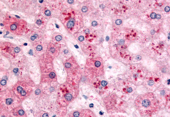 PYGL Antibody in Immunohistochemistry (Paraffin) (IHC (P))