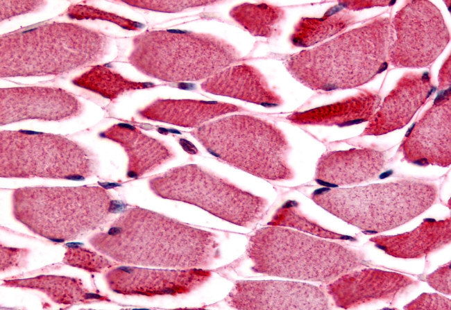 PYGM Antibody in Immunohistochemistry (Paraffin) (IHC (P))