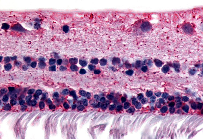 RGR Antibody in Immunohistochemistry (Paraffin) (IHC (P))