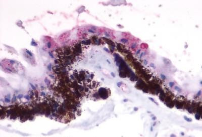 RGR Antibody in Immunohistochemistry (Paraffin) (IHC (P))