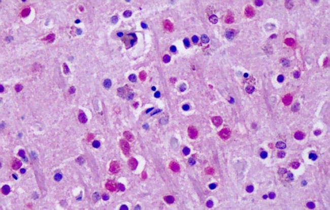 RORA Antibody in Immunohistochemistry (Paraffin) (IHC (P))