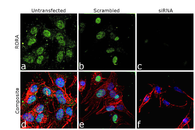 RORA Antibody