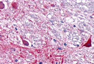 RORA Antibody in Immunohistochemistry (Paraffin) (IHC (P))