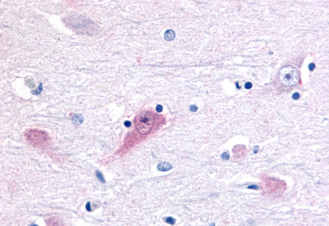 RORB Antibody in Immunohistochemistry (Paraffin) (IHC (P))