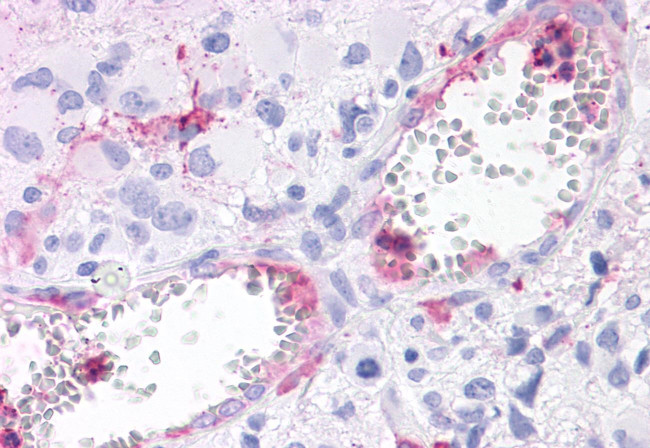 ROR gamma Antibody in Immunohistochemistry (Paraffin) (IHC (P))