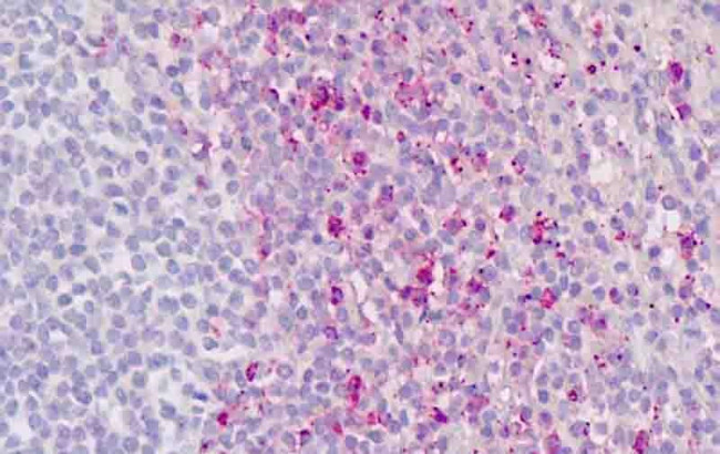 ROR gamma Antibody in Immunohistochemistry (Paraffin) (IHC (P))