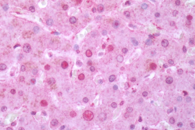 ROR gamma Antibody in Immunohistochemistry (Paraffin) (IHC (P))