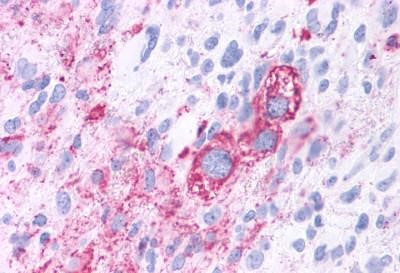 ROR gamma Antibody in Immunohistochemistry (Paraffin) (IHC (P))