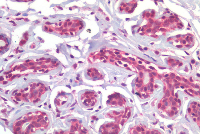 ROR gamma Antibody in Immunohistochemistry (Paraffin) (IHC (P))