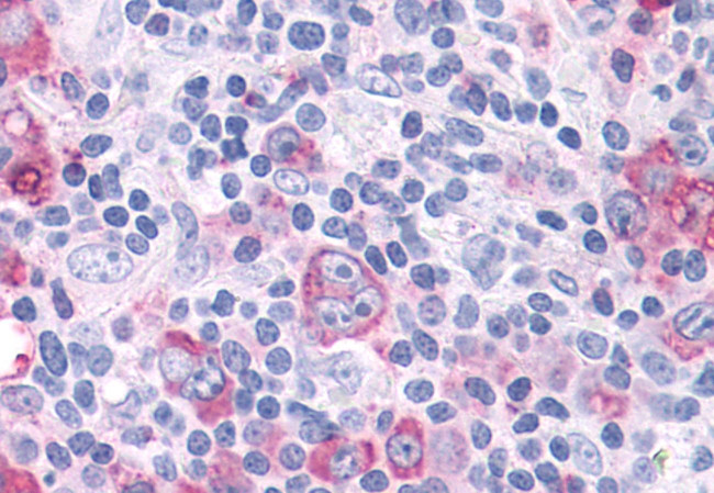 ROR gamma Antibody in Immunohistochemistry (Paraffin) (IHC (P))