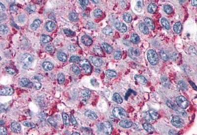 ROR gamma Antibody in Immunohistochemistry (Paraffin) (IHC (P))