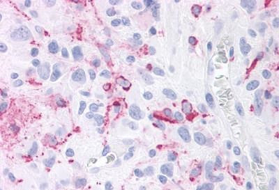 ROR gamma Antibody in Immunohistochemistry (Paraffin) (IHC (P))