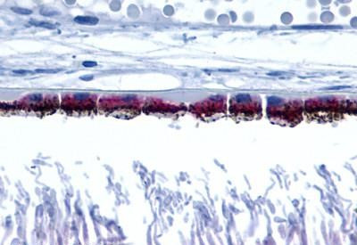 RRH Antibody in Immunohistochemistry (Paraffin) (IHC (P))