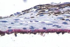 RRH Antibody in Immunohistochemistry (Paraffin) (IHC (P))