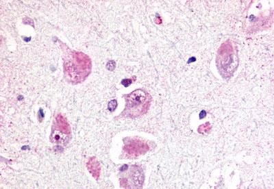 RXFP3 Antibody in Immunohistochemistry (Paraffin) (IHC (P))