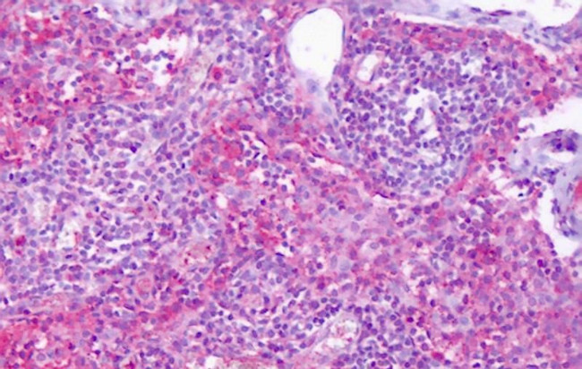 EDG6 Antibody in Immunohistochemistry (Paraffin) (IHC (P))