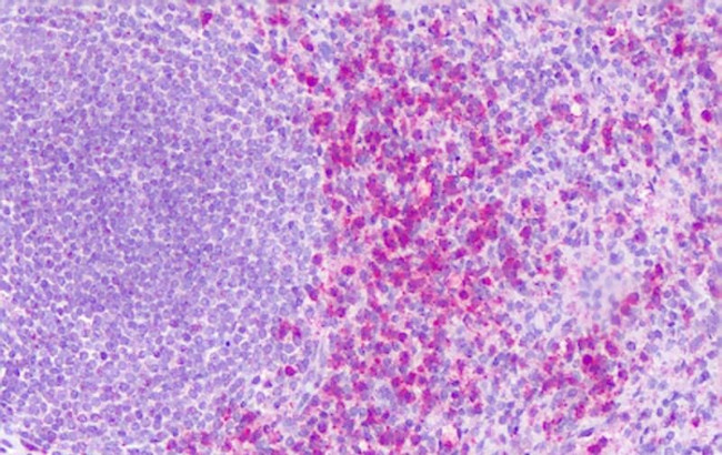 EDG6 Antibody in Immunohistochemistry (Paraffin) (IHC (P))