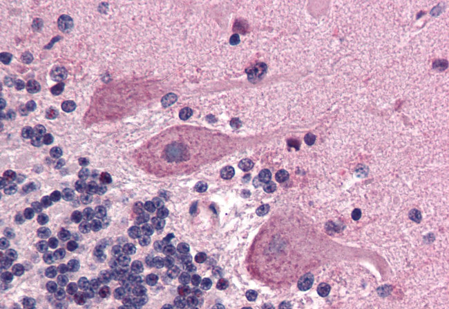 SCN1A Antibody in Immunohistochemistry (Paraffin) (IHC (P))