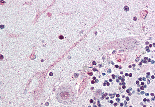 SCN3A Antibody in Immunohistochemistry (Paraffin) (IHC (P))