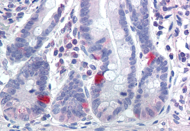 SCN9A Antibody in Immunohistochemistry (Paraffin) (IHC (P))