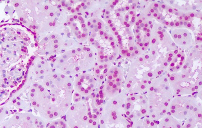 SGK2 Antibody in Immunohistochemistry (Paraffin) (IHC (P))