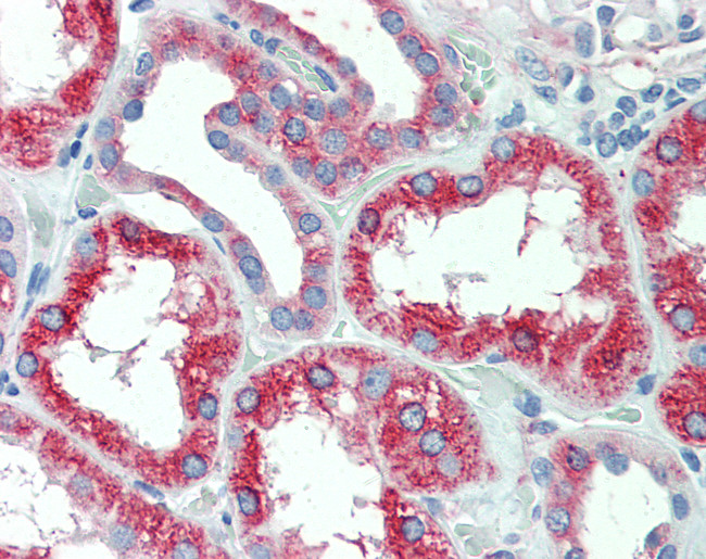 SLC11A2 Antibody in Immunohistochemistry (Paraffin) (IHC (P))