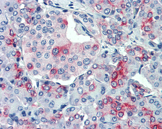 SLC11A2 Antibody in Immunohistochemistry (Paraffin) (IHC (P))