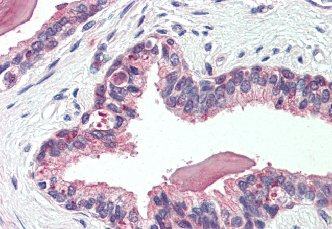 NKCC1 Antibody in Immunohistochemistry (Paraffin) (IHC (P))