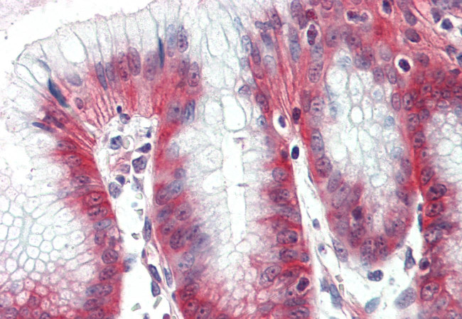 NKCC1 Antibody in Immunohistochemistry (Paraffin) (IHC (P))