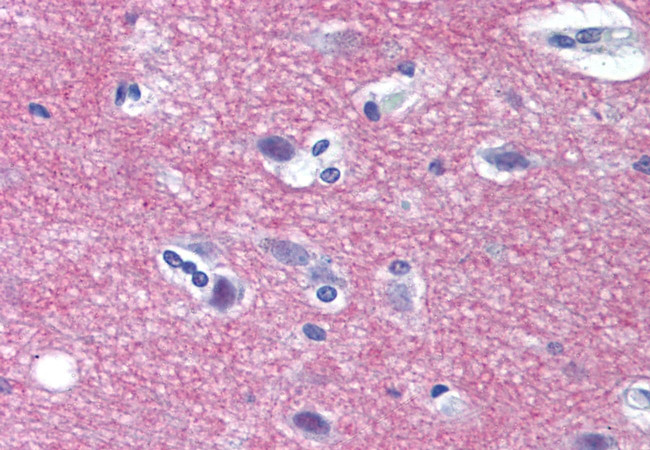 Syntaxin 1 Antibody in Immunohistochemistry (Paraffin) (IHC (P))