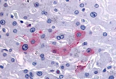 HRD1 Antibody in Immunohistochemistry (Paraffin) (IHC (P))