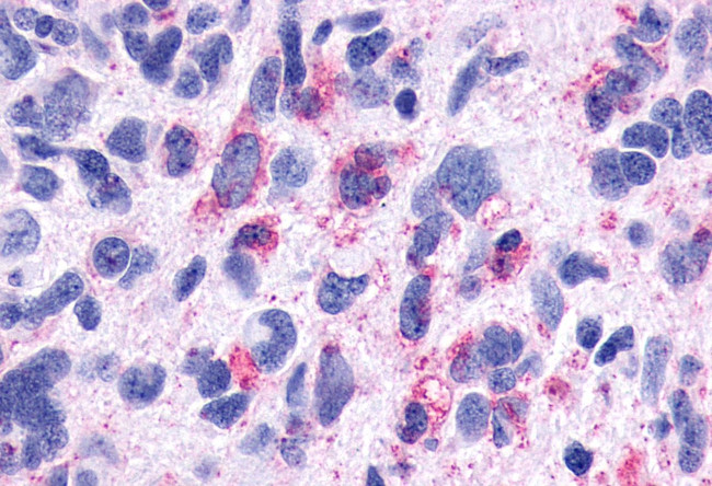 TACR3 Antibody in Immunohistochemistry (Paraffin) (IHC (P))