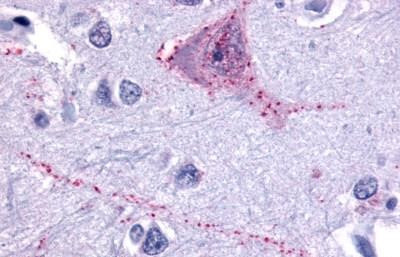 TACR3 Antibody in Immunohistochemistry (Paraffin) (IHC (P))