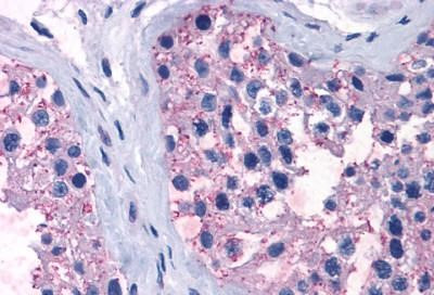 TAS1R1 Antibody in Immunohistochemistry (Paraffin) (IHC (P))