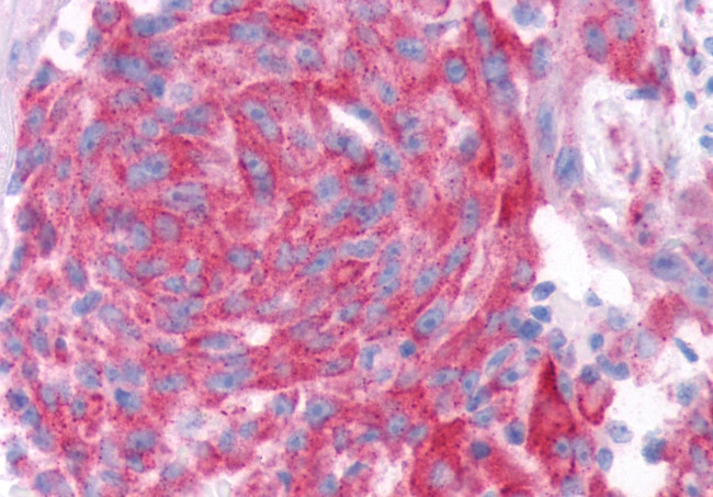 TAS1R2 Antibody in Immunohistochemistry (Paraffin) (IHC (P))