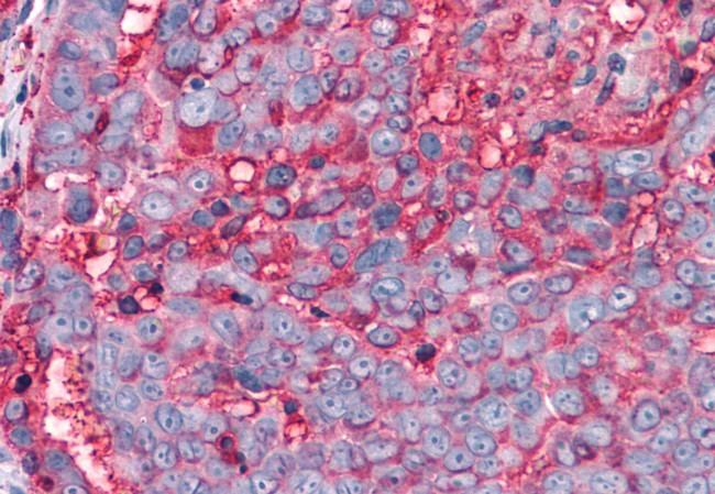 TAS1R3 Antibody in Immunohistochemistry (Paraffin) (IHC (P))