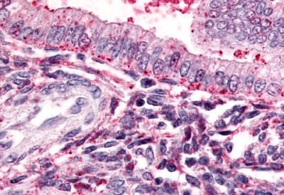 TBXA2R Antibody in Immunohistochemistry (Paraffin) (IHC (P))