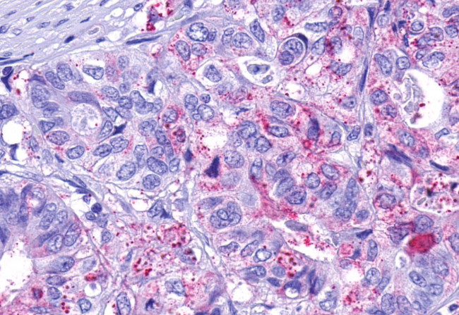 PAR1 Antibody in Immunohistochemistry (Paraffin) (IHC (P))