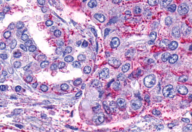 PAR1 Antibody in Immunohistochemistry (Paraffin) (IHC (P))