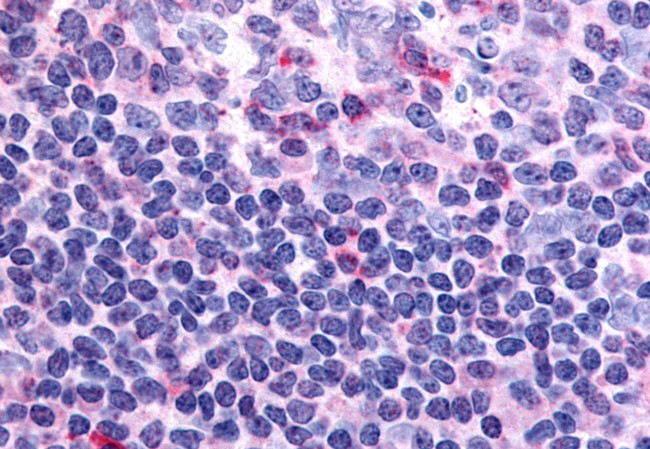 PAR1 Antibody in Immunohistochemistry (Paraffin) (IHC (P))