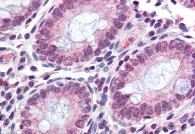 TMPRSS4 Antibody in Immunohistochemistry (Paraffin) (IHC (P))