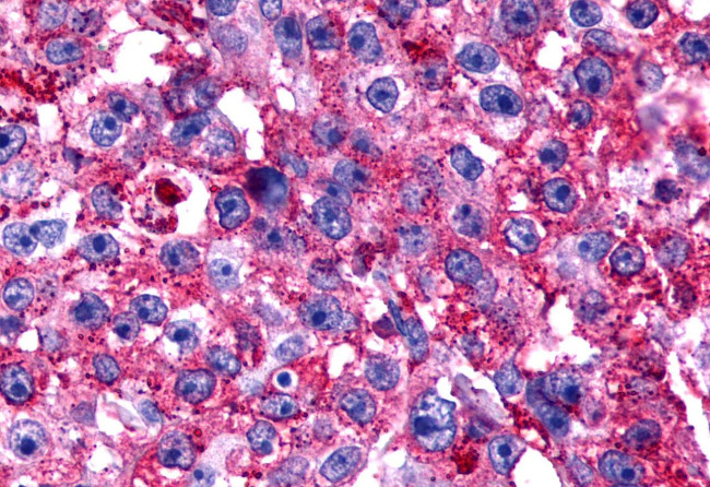 TPRA1 Antibody in Immunohistochemistry (Paraffin) (IHC (P))