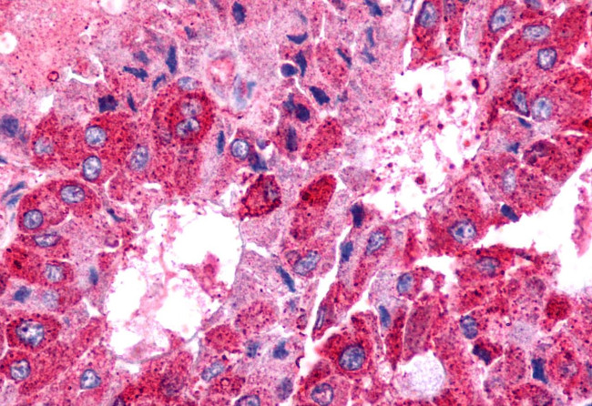 TPRA1 Antibody in Immunohistochemistry (Paraffin) (IHC (P))